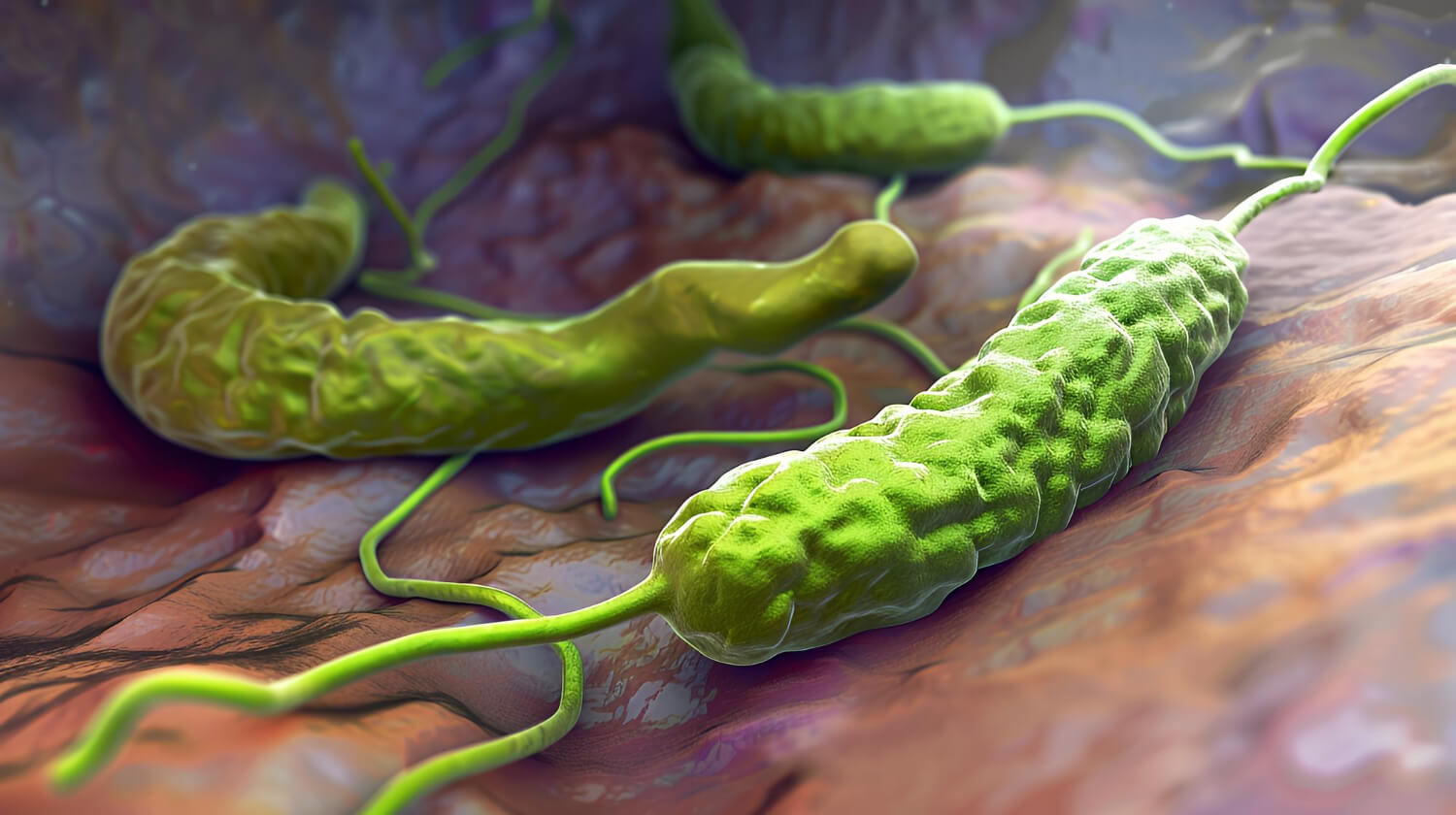 Helicobacter Pylori