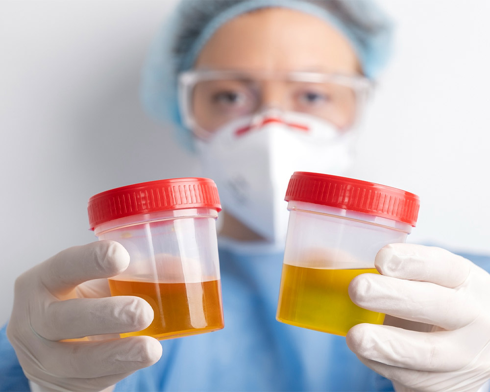 Infección de Orina o Cistitis