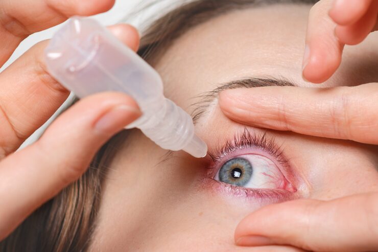 Conjuntivitis y sus Síntomas: Tratamiento y Recetas en 15 min